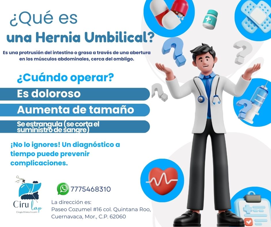 Información de hernia umbilical
